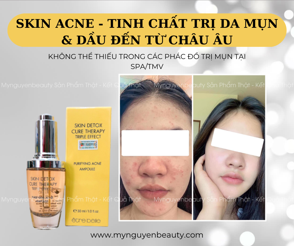 skin acne etre belle